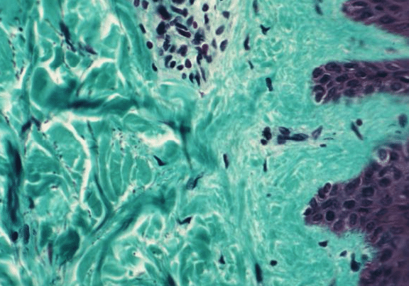 The Science Behind Hydrolyzed Type I Collagen Fragments