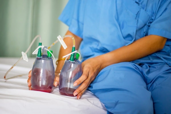 nurse or doctor showing how a surgical drain works