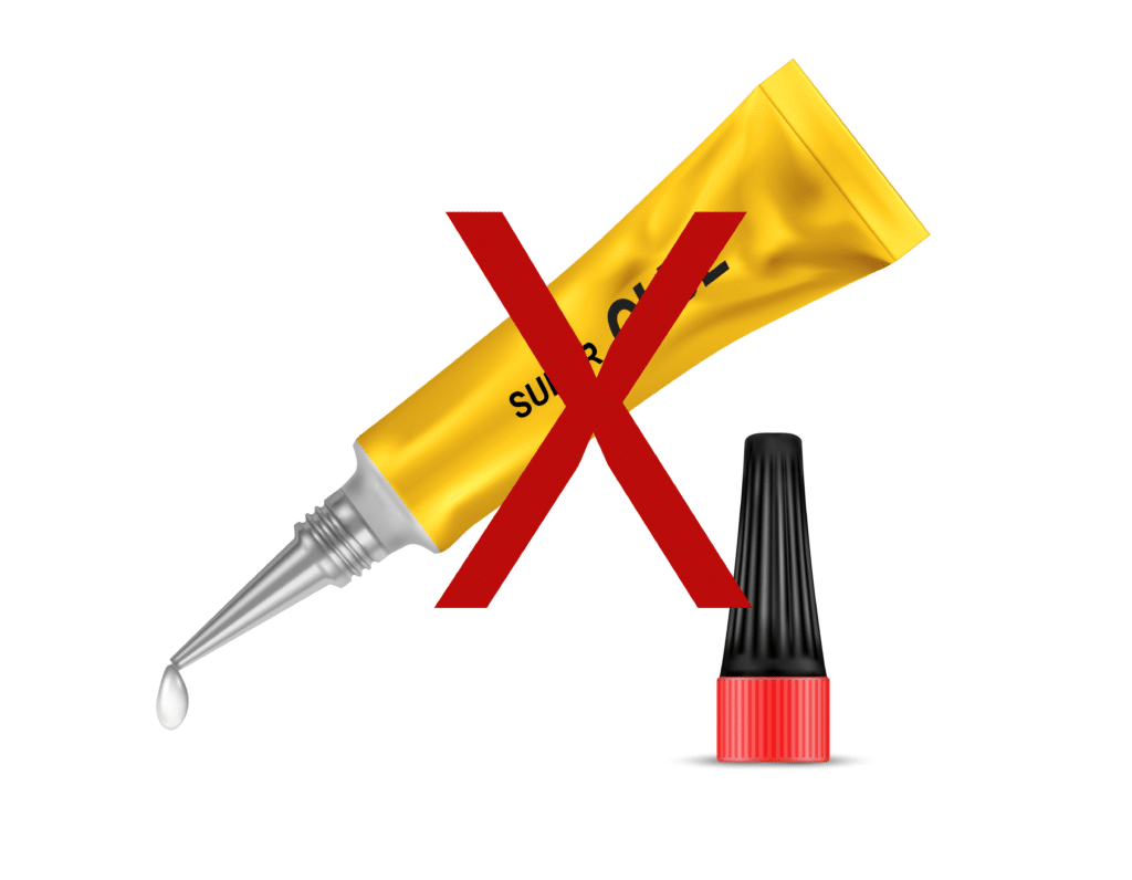 An Overview of Surgical Glues, Sealants and Other Adhesives Sanara