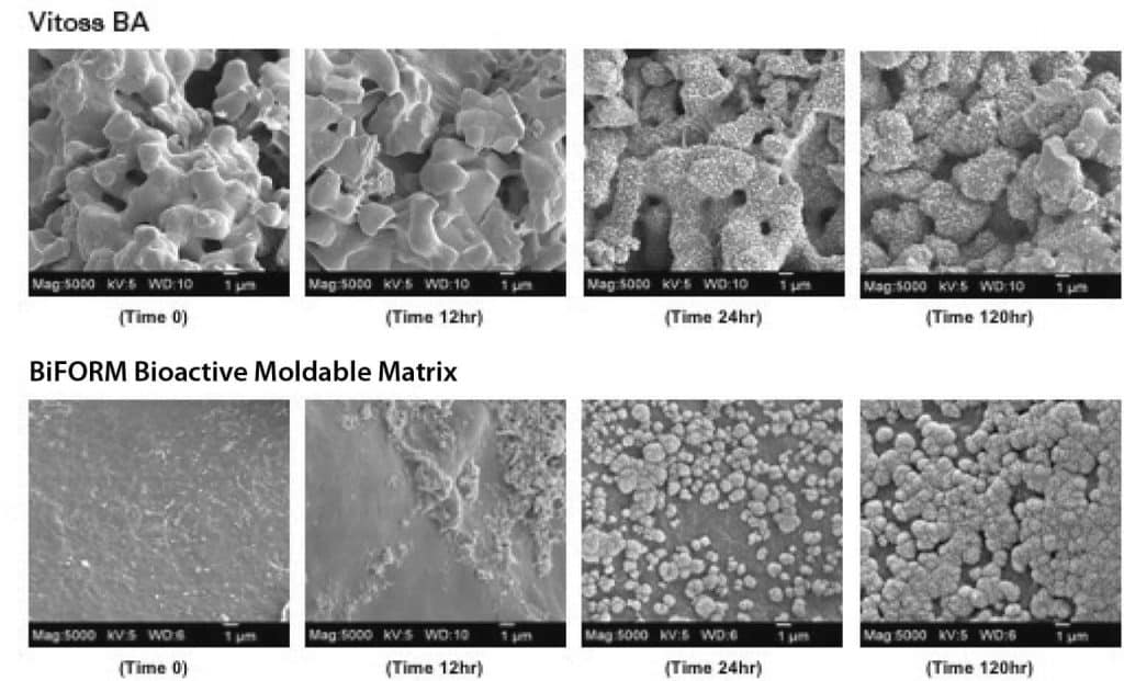 FESEM Images of BiFORM® Bioactive Moldable Matrix vs. Vitoss BA Incubated in SBF from 0 to 120 hours